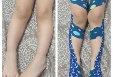 Recuperare Kinetoterapie Slobozia Clinica de recuperare Slobozia - Clinica ANDILOR
