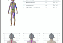 Recuperare Kinetoterapie Bradesti Recuperare Kinetoterapie Bradesti - MEDANO CLINIC